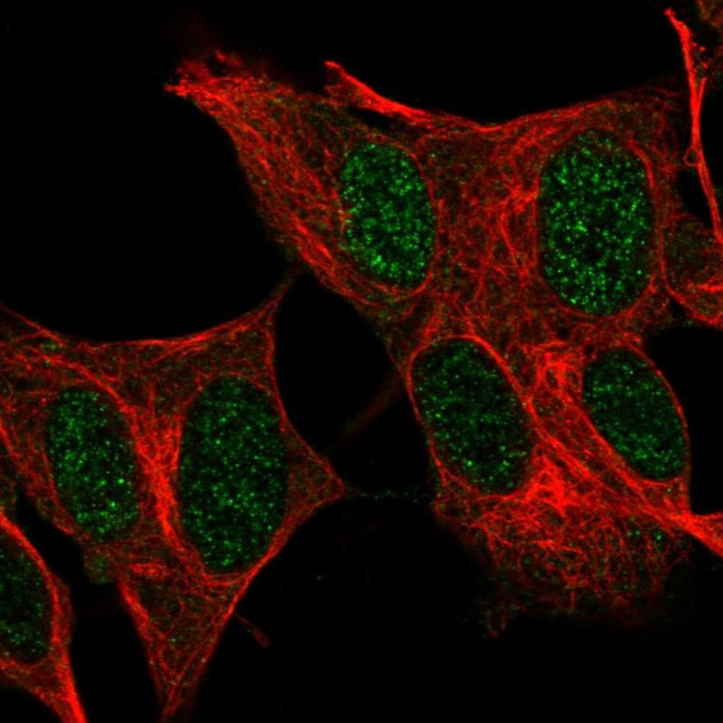 FOXR2 Antibody in Immunocytochemistry (ICC/IF)