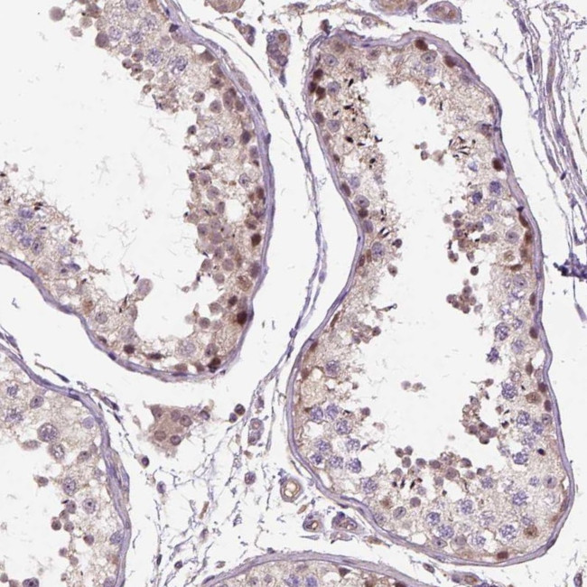 CF106 Antibody in Immunohistochemistry (Paraffin) (IHC (P))