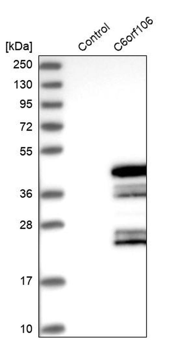 CF106 Antibody in Western Blot (WB)