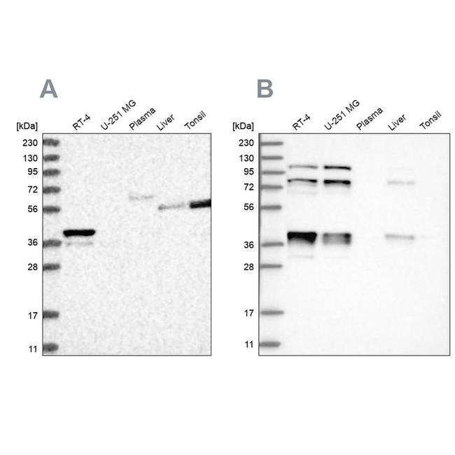 PLEKHA3 Antibody in Western Blot (WB)