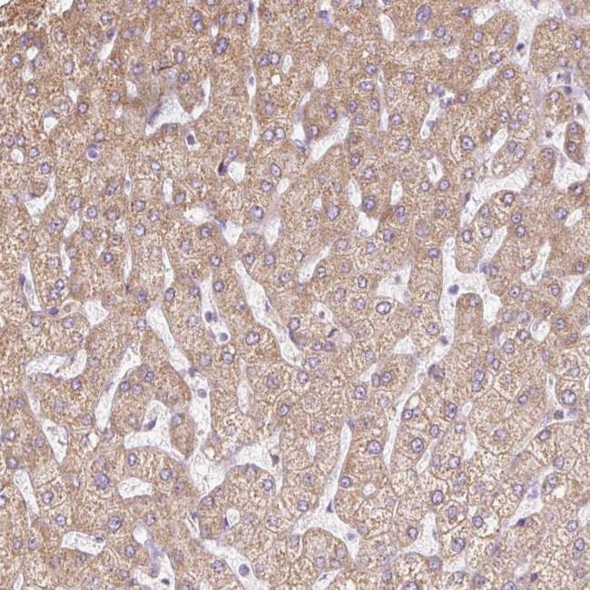 ERAP2 Antibody in Immunohistochemistry (Paraffin) (IHC (P))