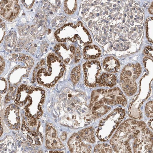 PPP1R7 Antibody in Immunohistochemistry (IHC)
