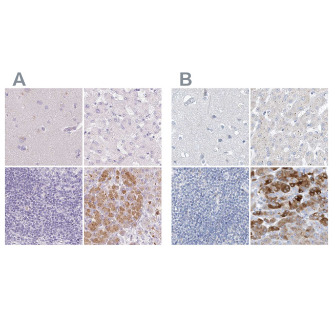 CTRL Antibody in Immunohistochemistry (IHC)