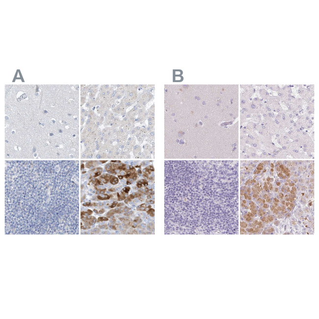 CTRL Antibody in Immunohistochemistry (IHC)
