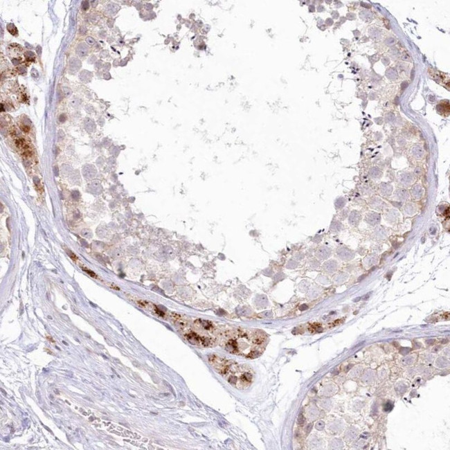 MTMR3 Antibody in Immunohistochemistry (IHC)