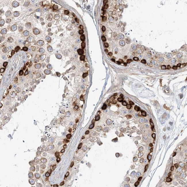 MTMR3 Antibody in Immunohistochemistry (Paraffin) (IHC (P))