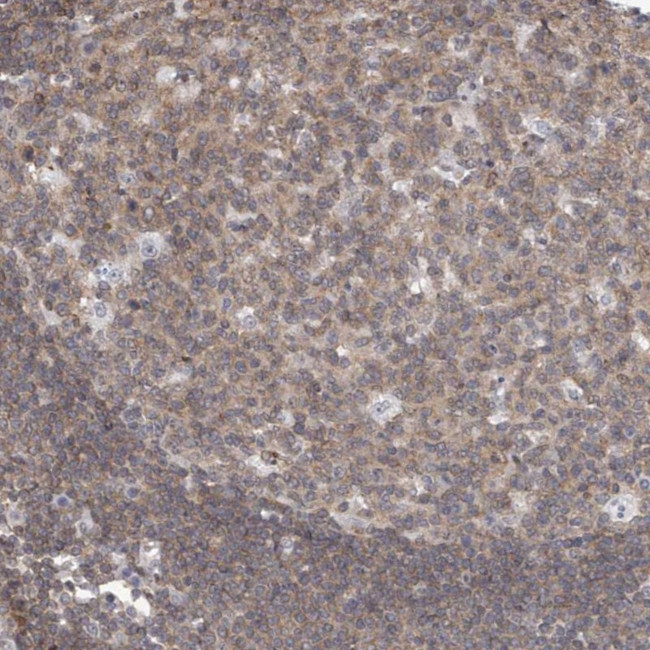 MSL3 Antibody in Immunohistochemistry (Paraffin) (IHC (P))