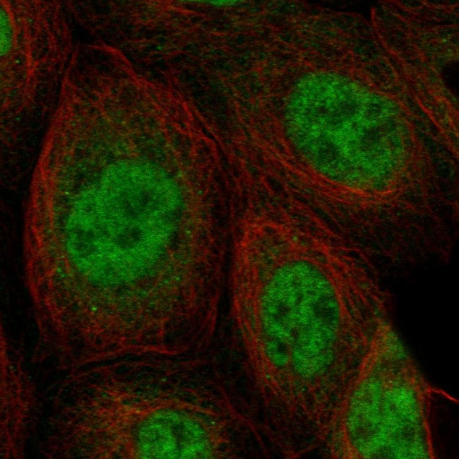 SNRNP27 Antibody in Immunocytochemistry (ICC/IF)