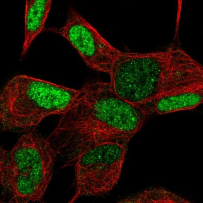 TGIF2LX Antibody in Immunocytochemistry (ICC/IF)