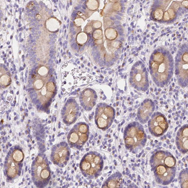 RNF186 Antibody in Immunohistochemistry (Paraffin) (IHC (P))