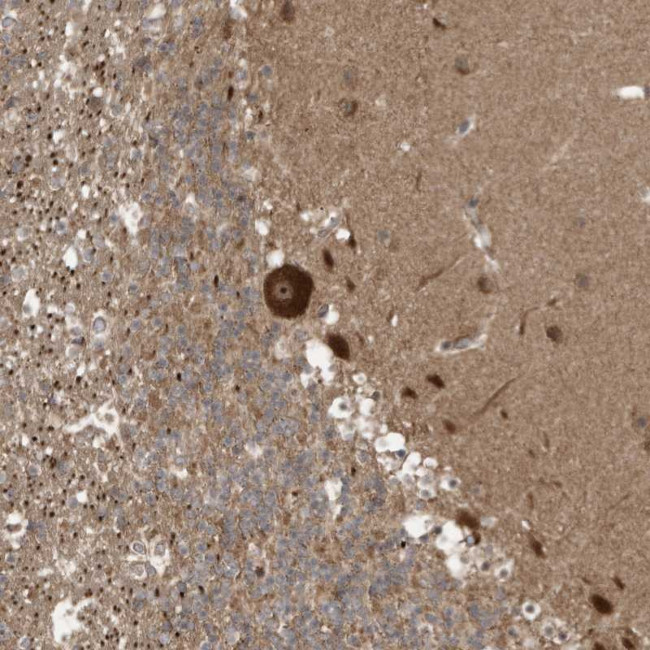 CARF Antibody in Immunohistochemistry (Paraffin) (IHC (P))