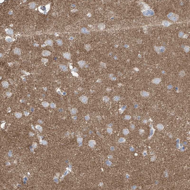 Synapsin 3 Antibody in Immunohistochemistry (Paraffin) (IHC (P))