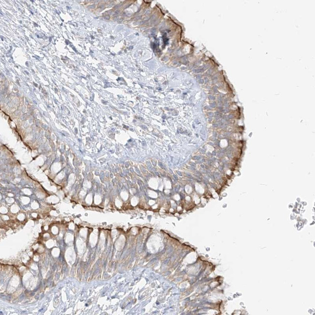 ZIM3 Antibody in Immunohistochemistry (Paraffin) (IHC (P))