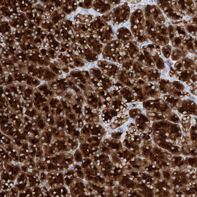 PPEF1 Antibody in Immunohistochemistry (Paraffin) (IHC (P))