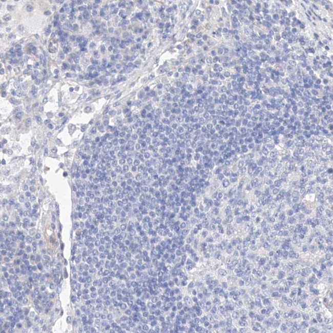 Mammaglobin B Antibody in Immunohistochemistry (Paraffin) (IHC (P))