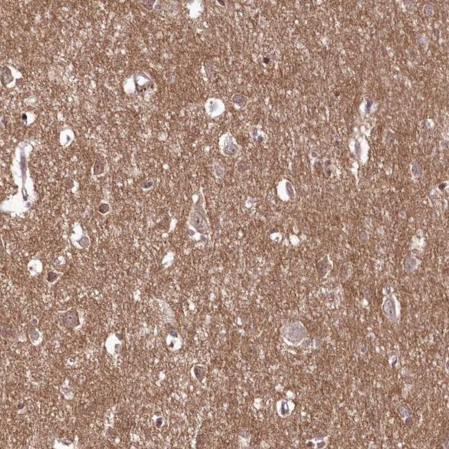 C10orf35 Antibody in Immunohistochemistry (IHC)