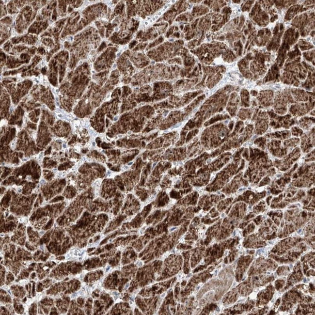 NDUFB3 Antibody in Immunohistochemistry (IHC)