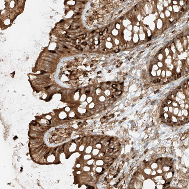 CCDC115 Antibody in Immunohistochemistry (Paraffin) (IHC (P))