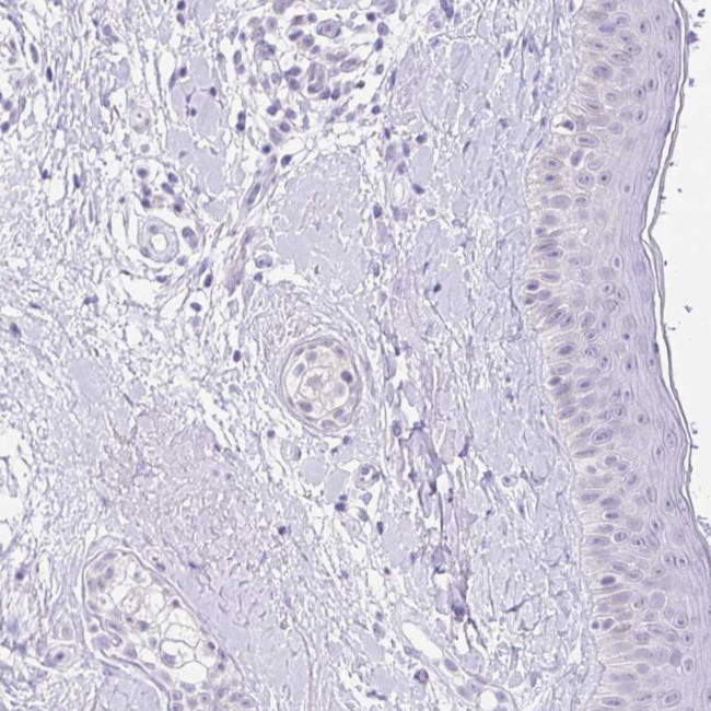 FATE1 Antibody in Immunohistochemistry (Paraffin) (IHC (P))