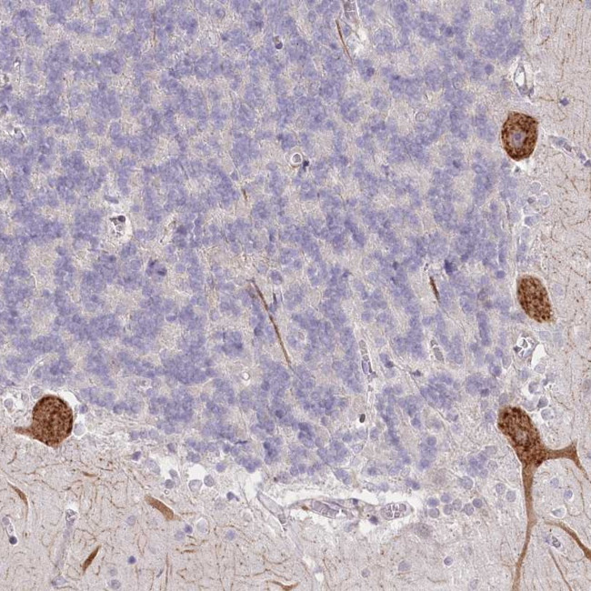 NCKAP5 Antibody in Immunohistochemistry (Paraffin) (IHC (P))
