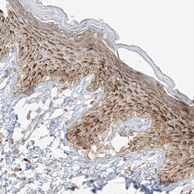 C2orf18 Antibody in Immunohistochemistry (Paraffin) (IHC (P))