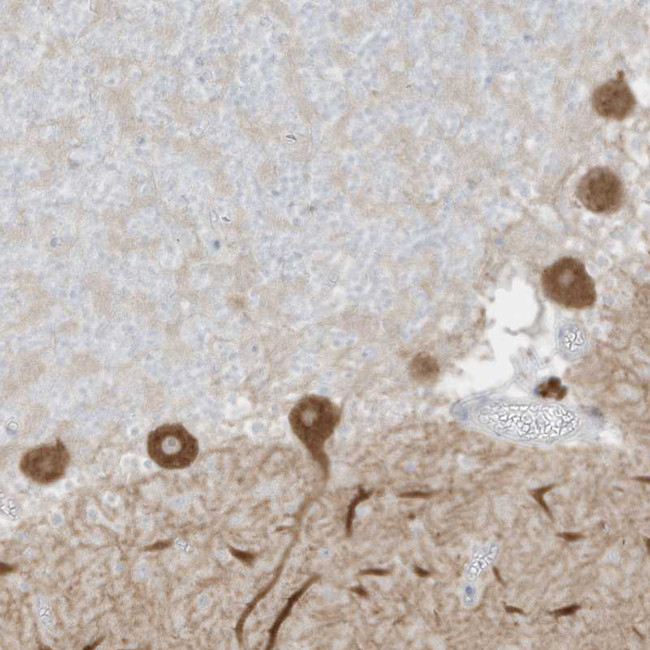 C11orf87 Antibody in Immunohistochemistry (Paraffin) (IHC (P))
