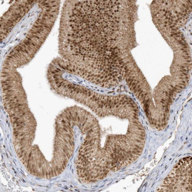 CPSF3 Antibody in Immunohistochemistry (IHC)
