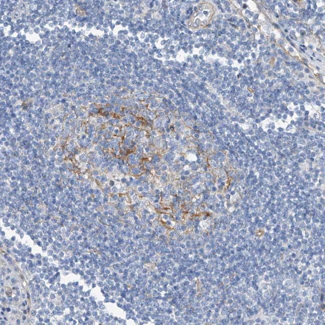 TENC1 Antibody in Immunohistochemistry (Paraffin) (IHC (P))