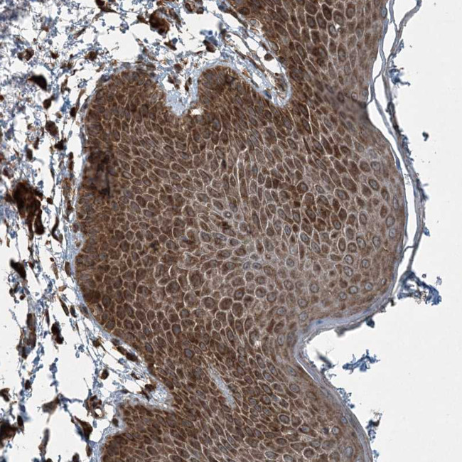 CSN7b Antibody in Immunohistochemistry (Paraffin) (IHC (P))