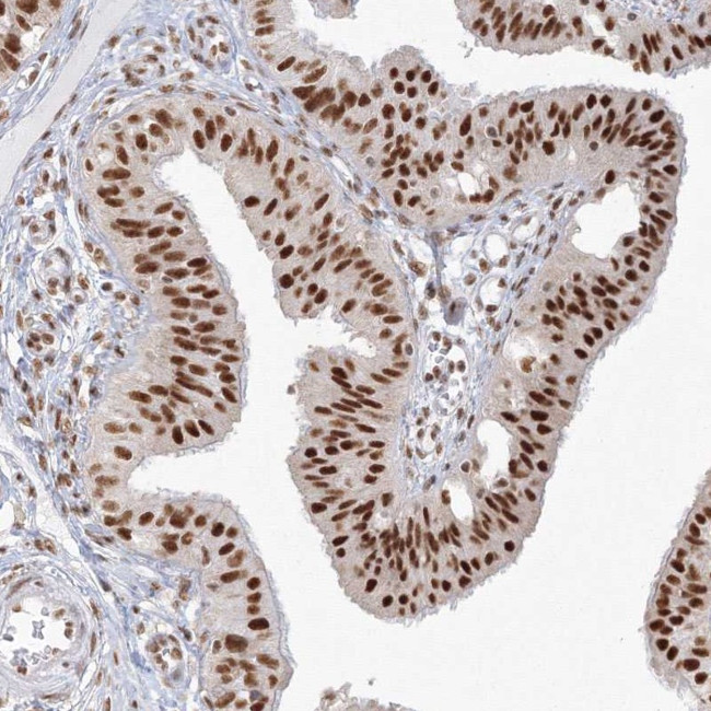 PPP4R2 Antibody in Immunohistochemistry (Paraffin) (IHC (P))