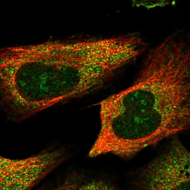 TSPYL6 Antibody in Immunocytochemistry (ICC/IF)