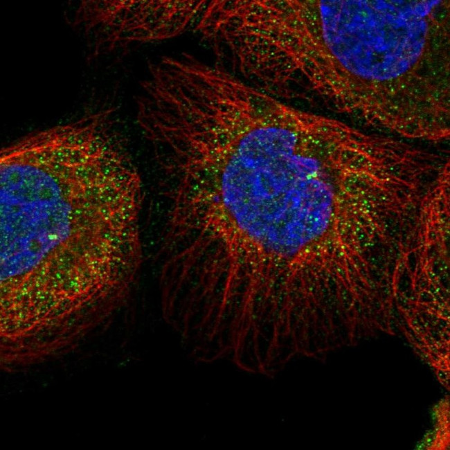 TSPYL6 Antibody in Immunocytochemistry (ICC/IF)