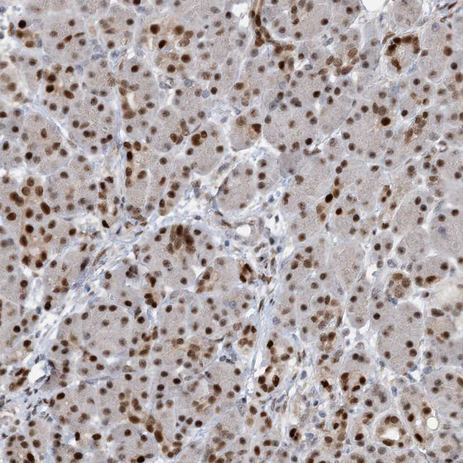 HEMK1 Antibody in Immunohistochemistry (Paraffin) (IHC (P))