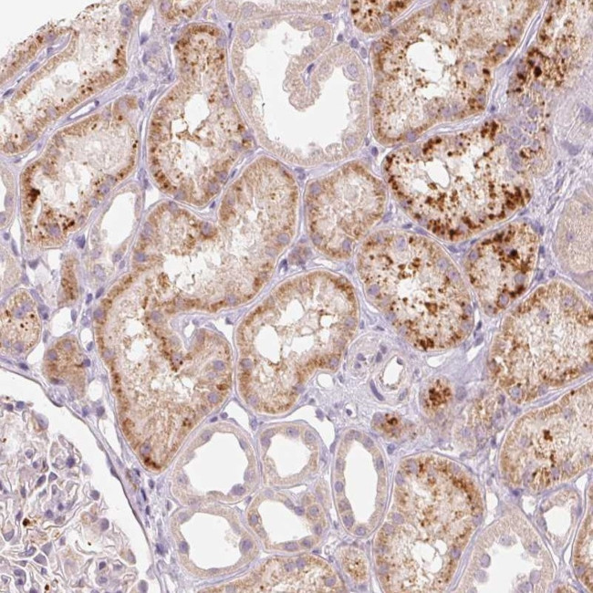 FAM82A1 Antibody in Immunohistochemistry (Paraffin) (IHC (P))