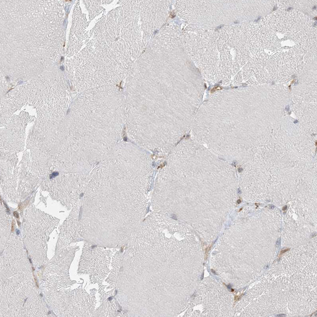 FAM119A Antibody in Immunohistochemistry (Paraffin) (IHC (P))