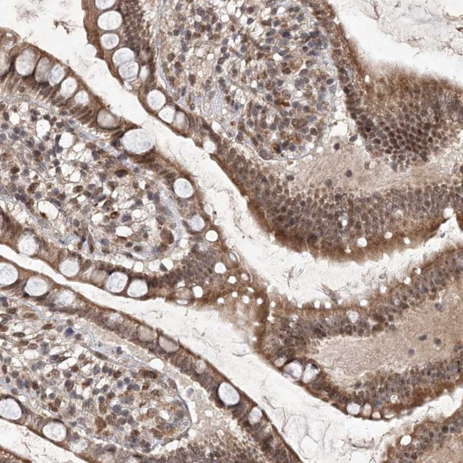 C3orf38 Antibody in Immunohistochemistry (Paraffin) (IHC (P))