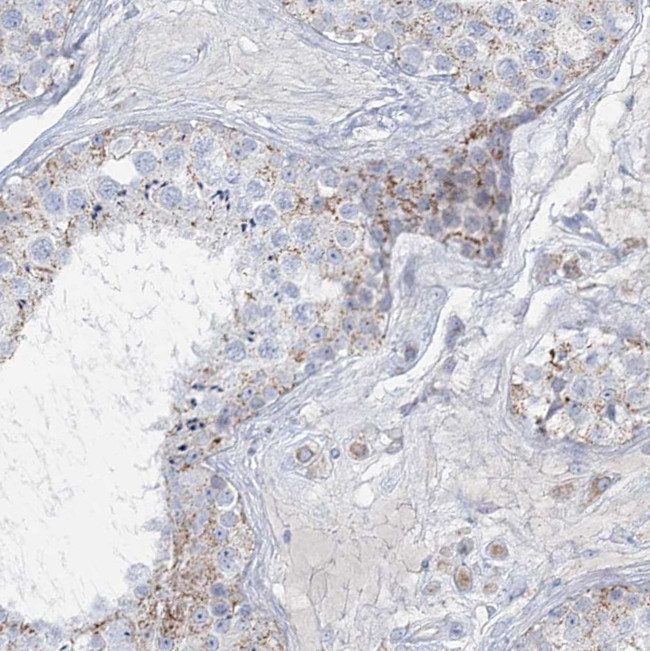 TBC1D7 Antibody in Immunohistochemistry (IHC)