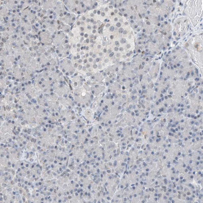 RBP7 Antibody in Immunohistochemistry (Paraffin) (IHC (P))