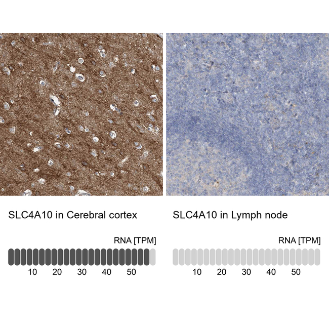 SLC4A10 Antibody in Immunohistochemistry (Paraffin) (IHC (P))