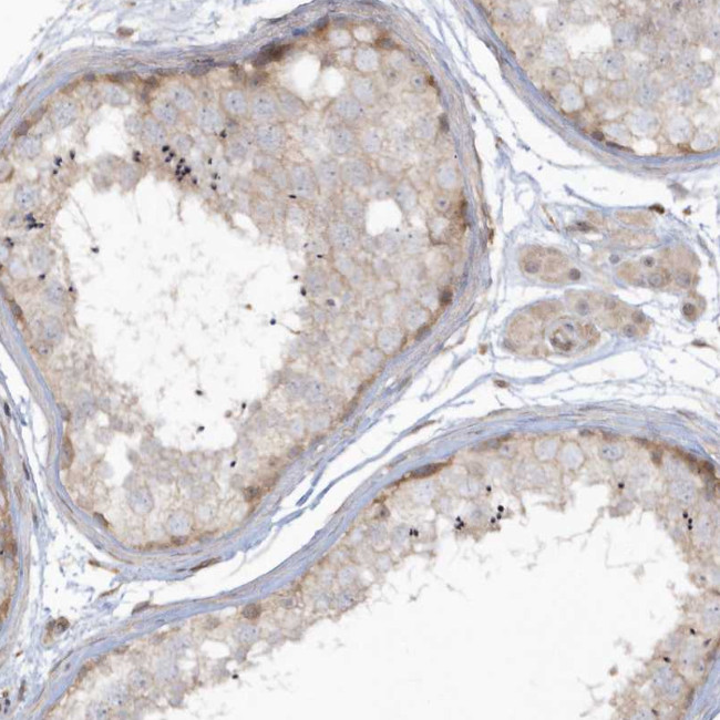 Bassoon Antibody in Immunohistochemistry (Paraffin) (IHC (P))