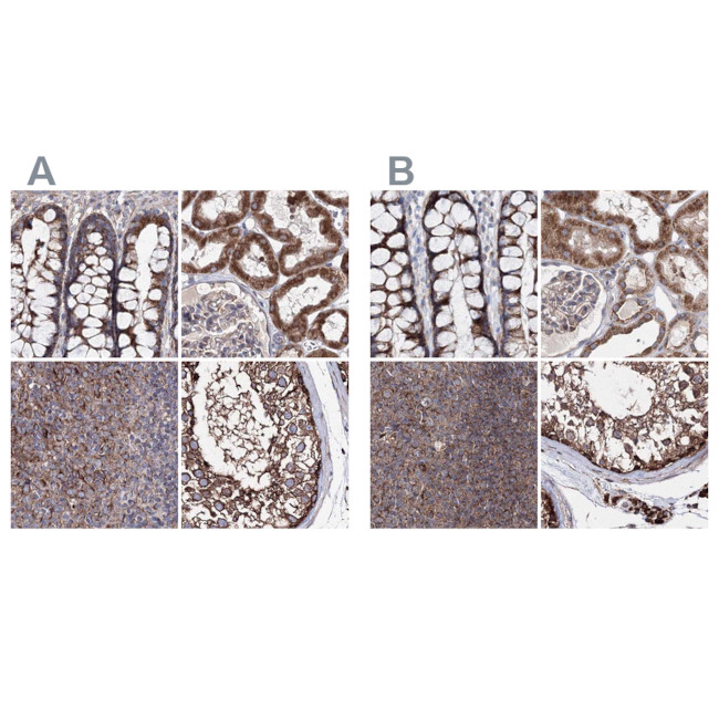 GFM1 Antibody in Immunohistochemistry (IHC)