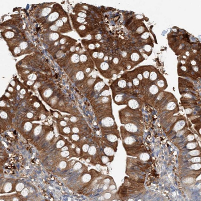 ARMH1 Antibody in Immunohistochemistry (Paraffin) (IHC (P))