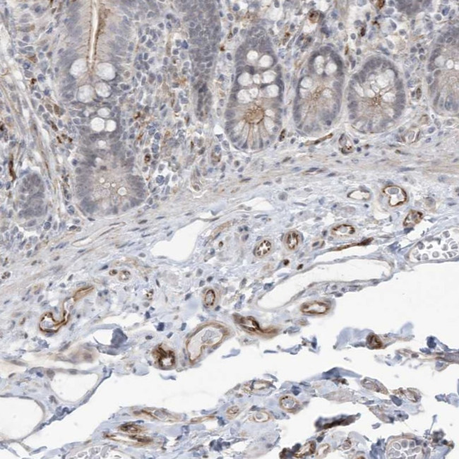 ADAMTSL3 Antibody in Immunohistochemistry (Paraffin) (IHC (P))