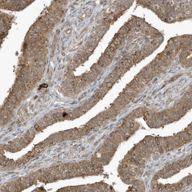 TRIM67 Antibody in Immunohistochemistry (Paraffin) (IHC (P))