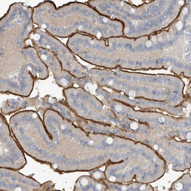 ZNF793 Antibody in Immunohistochemistry (Paraffin) (IHC (P))