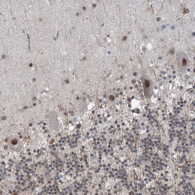 ZNF8 Antibody in Immunohistochemistry (Paraffin) (IHC (P))