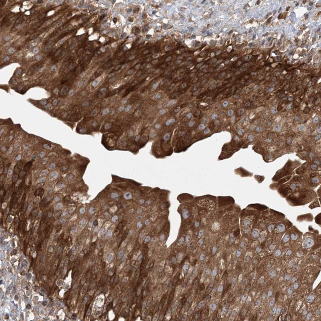 ACAP2 Antibody in Immunohistochemistry (Paraffin) (IHC (P))