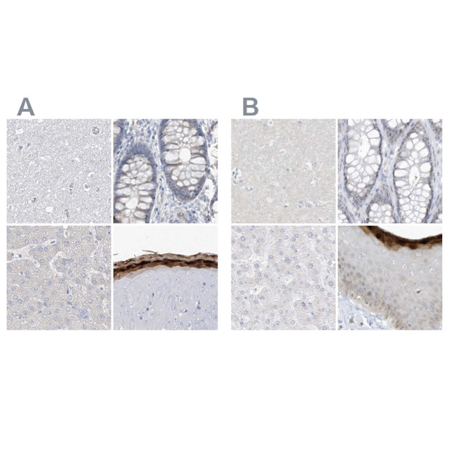 ASPRV1 Antibody in Immunohistochemistry (IHC)
