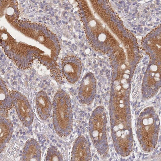 SLC35F5 Antibody in Immunohistochemistry (IHC)