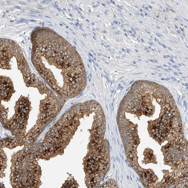 POMGNT2 Antibody in Immunohistochemistry (Paraffin) (IHC (P))